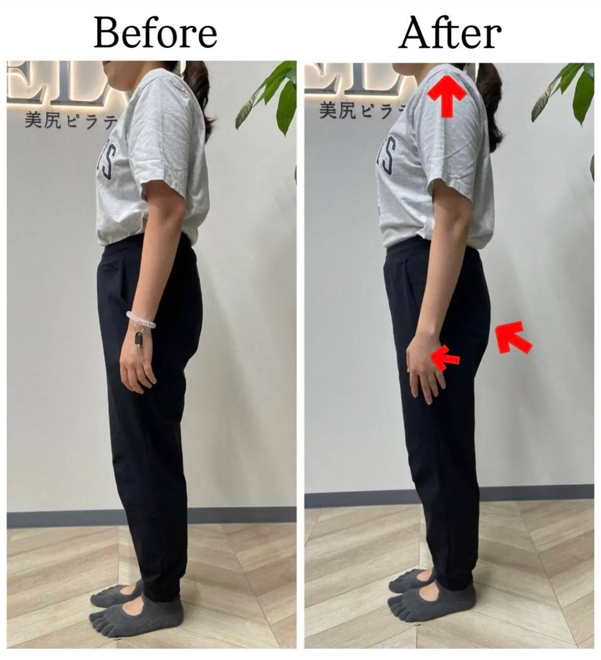 ELVI実績5
